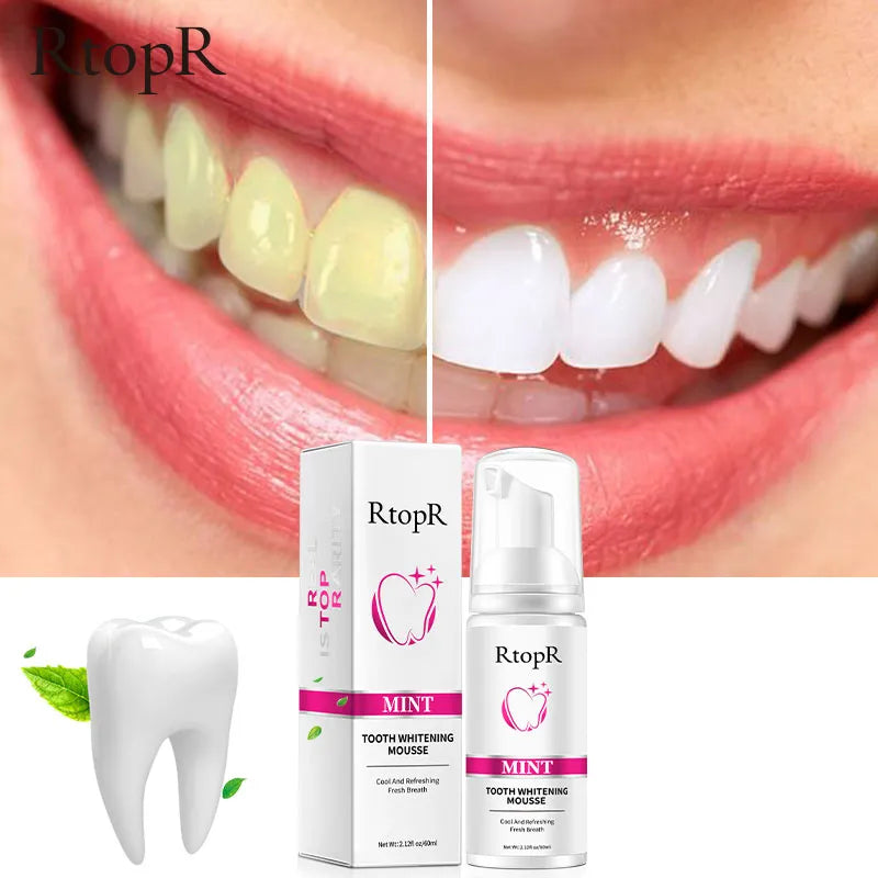 Teeth Cleansing Whitening Mousse Removes Stains